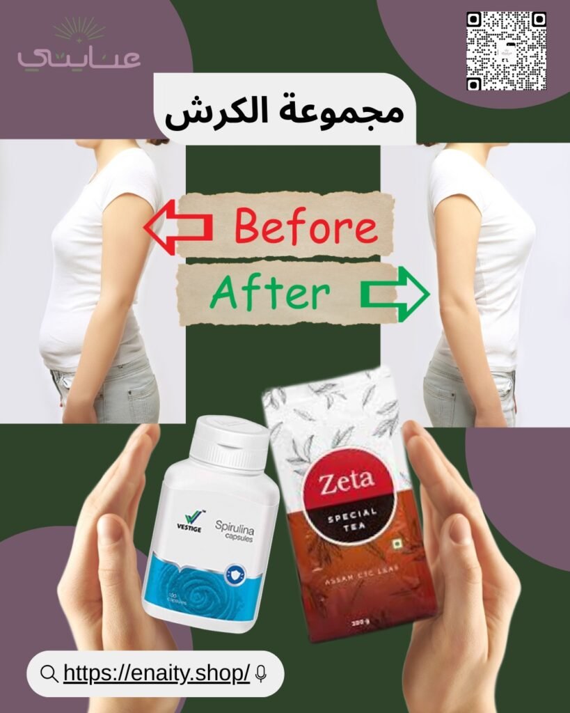 مجموعة الكرش الآمنه